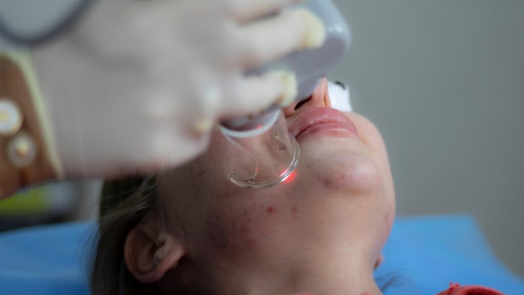 Dermatologist reviewing acne treatment options during a laser procedure